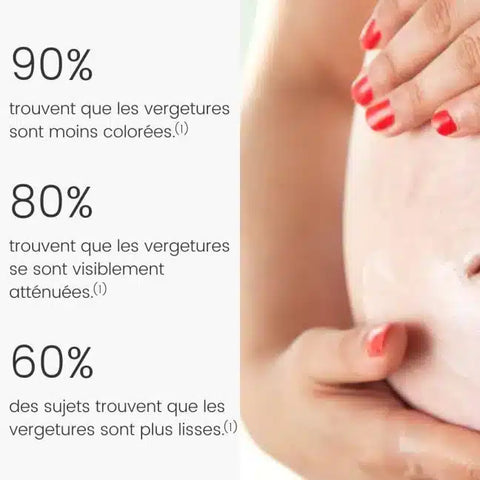 Baume SOS Vergetures 100 ml Laboratoires Téane - Blossom Care